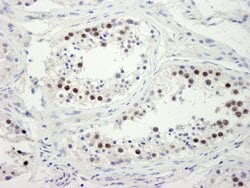 ZWINT-1 Polyclonal Antibody, Bethyl Laboratories 100 &mu;L | Buy Online | Bethyl Laboratories, Inc | Fisher Scientific