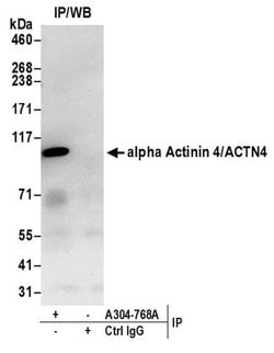 alpha Actinin 4/ACTN4 Rabbit anti-Human, Mouse, Polyclonal, Bethyl Laboratories