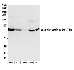 alpha Actinin 4/ACTN4 Rabbit anti-Human, Mouse, Polyclonal, Bethyl Laboratories
