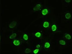 alpha-actinin (Actinin alpha 1) Mouse anti-Human, Clone: OTI7A4, lyophilized,