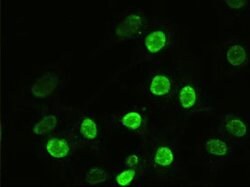 alpha-actinin (Actinin alpha 1) Mouse anti-Human, Clone: OTI7A4, liquid,