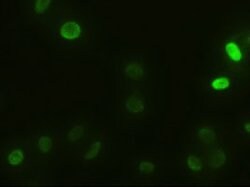 alpha-actinin (Actinin alpha 1) Mouse anti-Human, Clone: OTI7A4, lyophilized,