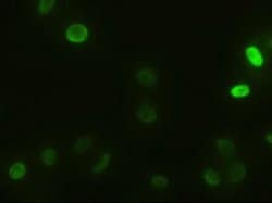 alpha-actinin (Actinin alpha 1) Mouse anti-Human, Clone: OTI7A4, liquid,
