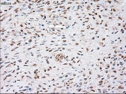 alpha-actinin (Actinin alpha 1) Mouse anti-Human, Clone: OTI7A4, lyophilized,