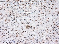 alpha-actinin (Actinin alpha 1) Mouse anti-Human, Clone: OTI7A4, liquid,