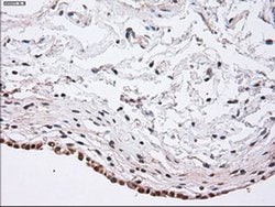 alpha-actinin (Actinin alpha 1) Mouse anti-Human, Clone: OTI7A4, liquid,