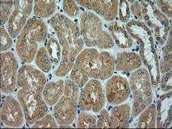 alpha-actinin (Actinin alpha 1) Mouse anti-Human, Clone: OTI7A4, lyophilized,