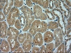 alpha-actinin (Actinin alpha 1) Mouse anti-Human, Clone: OTI7A4, liquid,