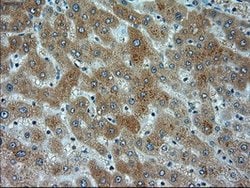 alpha-actinin (Actinin alpha 1) Mouse anti-Human, Clone: OTI7A4, lyophilized,