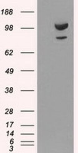 alpha-actinin (Actinin alpha 1) Mouse anti-Human, Clone: OTI7A4, lyophilized,