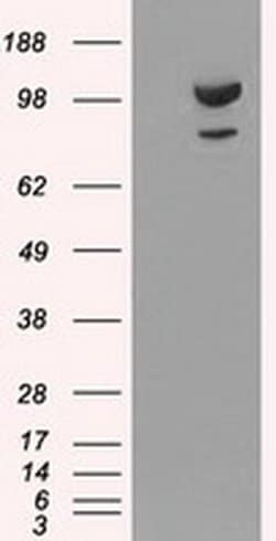 alpha-actinin (Actinin alpha 1) Mouse anti-Human, Clone: OTI7A4, liquid,