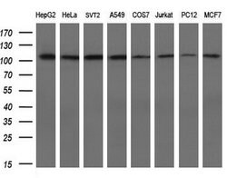 alpha-actinin (Actinin alpha 1) Mouse anti-Human, Clone: OTI7A4, lyophilized,