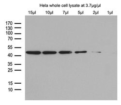 beta Actin Mouse anti-Canine, Human, Mouse, Rat, Clone: OTI1, TrueMAB ,