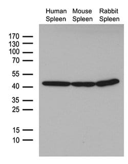 beta Actin Mouse anti-Canine, Human, Mouse, Rat, Clone: OTI1, TrueMAB ,