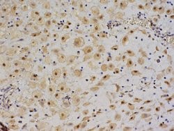 IGF 2 Rabbit anti-Human, Polyclonal, Bioss 100 &mu;L; Unconjugated:Antibodies,