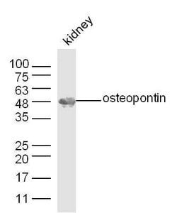 Osteopontin Rabbit anti-Human, Polyclonal, Bioss 100 &mu;L; Unconjugated:Antibodies,