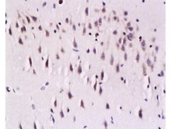 Calcineurin A Mouse anti-Human, Polyclonal, Bioss 100 &mu;L; Unconjugated:Antibodies,