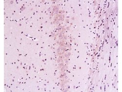 Calcineurin A Mouse anti-Human, Polyclonal, Bioss 100 &mu;L; Unconjugated:Antibodies,
