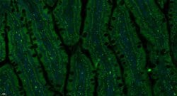 Insulin Receptor alpha Rabbit anti-Human, Polyclonal, Bioss 100 &mu;L;