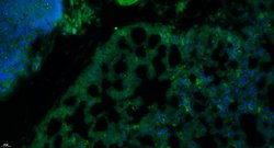 Insulin Receptor alpha Rabbit anti-Human, Polyclonal, Bioss 100 &mu;L;