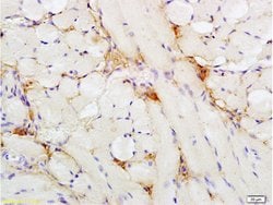 Insulin Receptor alpha Rabbit anti-Human, Polyclonal, Bioss 100 &mu;L;