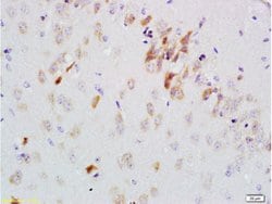 GDNF Receptor alpha 2 Rabbit anti-Human, Polyclonal, Bioss 100 &mu;L; Unconjugated:Antibodies,