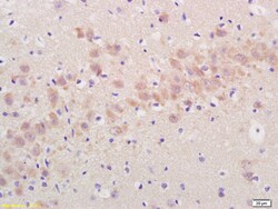 Artemin Rabbit anti-Human, Polyclonal, Bioss 100 &mu;L; Unconjugated:Antibodies,