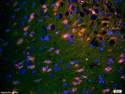 Neurokinin 1 Receptor Rabbit anti-Human, Polyclonal, Bioss 100 &mu;L; Unconjugated:Antibodies,