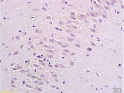 Neurokinin 1 Receptor Rabbit anti-Human, Polyclonal, Bioss 100 &mu;L; Unconjugated:Antibodies,