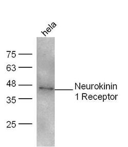 Neurokinin 1 Receptor Rabbit anti-Human, Polyclonal, Bioss 100 &mu;L; Unconjugated:Antibodies,