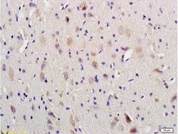 VIP Rabbit anti-Human, Polyclonal, Bioss 100 &mu;L; Unconjugated:Antibodies,