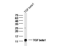 TGF beta 1 Rabbit anti-Human, Polyclonal, Bioss 100 &mu;L; Unconjugated:Antibodies,