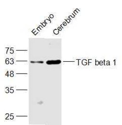 TGF beta 1 Rabbit anti-Human, Polyclonal, Bioss 100 &mu;L; Unconjugated:Antibodies,