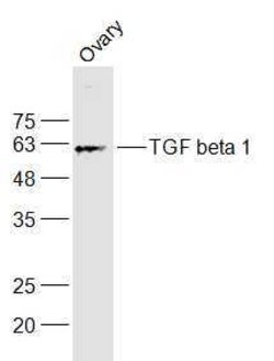 TGF beta 1 Rabbit anti-Human, Polyclonal, Bioss 100 &mu;L; Unconjugated:Antibodies,