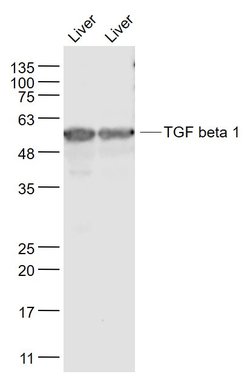 TGF beta 1 Rabbit anti-Human, Polyclonal, Bioss 100 &mu;L; Unconjugated:Antibodies,