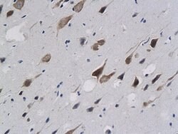 Calponin 1 Rabbit anti-Human, Polyclonal, Bioss 100 &mu;L; Unconjugated:Antibodies,