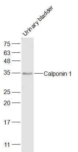 Calponin 1 Rabbit anti-Human, Polyclonal, Bioss 100 &mu;L; Unconjugated:Antibodies,