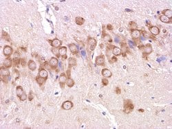 beta Amyloid 1-42 Rabbit anti-Human, Polyclonal, Bioss 100 &mu;L; Unconjugated:Antibodies,