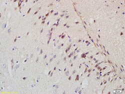 Amyloid Precursor Protein Rabbit anti-Human, Polyclonal, Bioss 100 &mu;L;