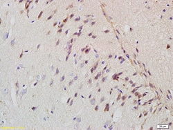 Amyloid Precursor Protein Rabbit anti-Human, Polyclonal, Bioss 100 &mu;L;