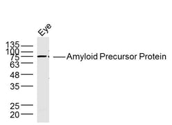 Amyloid Precursor Protein Rabbit anti-Human, Polyclonal, Bioss 100 &mu;L;