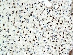 Estrogen receptor beta Rabbit anti-Human, Polyclonal, Bioss 100 &mu;L;