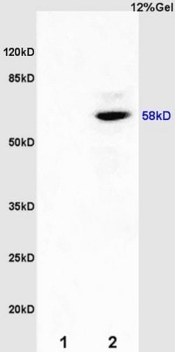 Estrogen receptor beta Rabbit anti-Human, Polyclonal, Bioss 100 &mu;L;