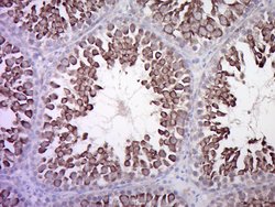 Calcitonin receptor Rabbit anti-Human, Polyclonal, Bioss 100 &mu;L; Unconjugated:Antibodies,