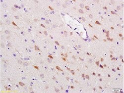 HSP70 Rabbit anti-Human, Polyclonal, Bioss 100 &mu;L; Unconjugated:Antibodies,
