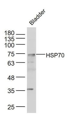 HSP70 Rabbit anti-Human, Polyclonal, Bioss 100 &mu;L; Unconjugated:Antibodies,