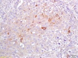 CRP Rabbit anti-Human, Polyclonal, Bioss 100 &mu;L; Unconjugated:Antibodies,