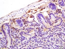CRP Rabbit anti-Human, Polyclonal, Bioss 100 &mu;L; Unconjugated:Antibodies,