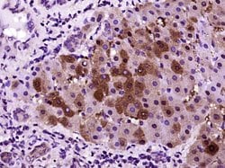 CRP Rabbit anti-Human, Polyclonal, Bioss 100 &mu;L; Unconjugated:Antibodies,