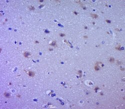 EGFR Rabbit anti-Human, Polyclonal, Bioss 100 &mu;L; Unconjugated:Antibodies,